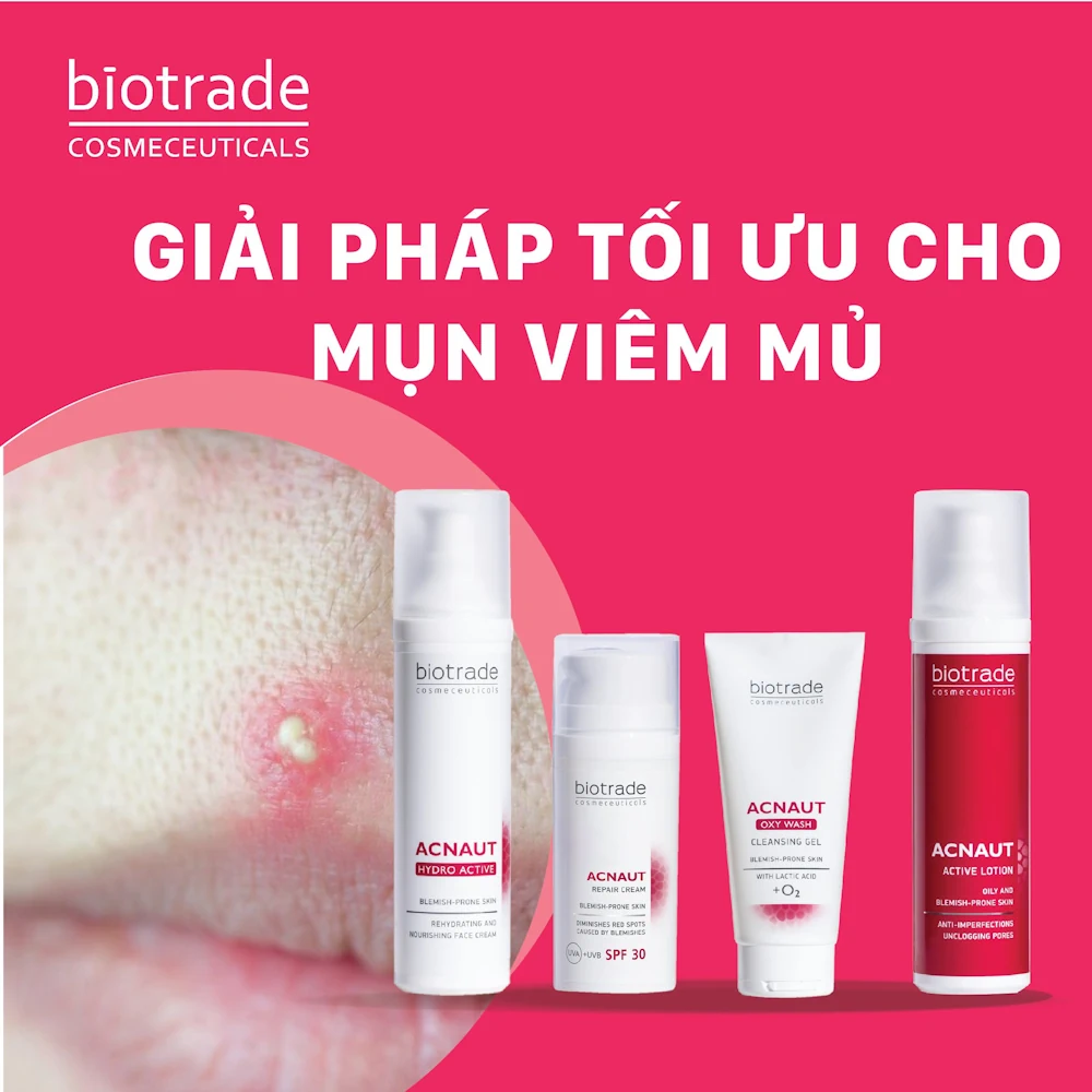 Combo Giảm Mụn Viêm Mủ Biotrade Acnaut - Giải Pháp Tối ưu Cho Mụn Viêm Mủ - Siêu Thị Droppii