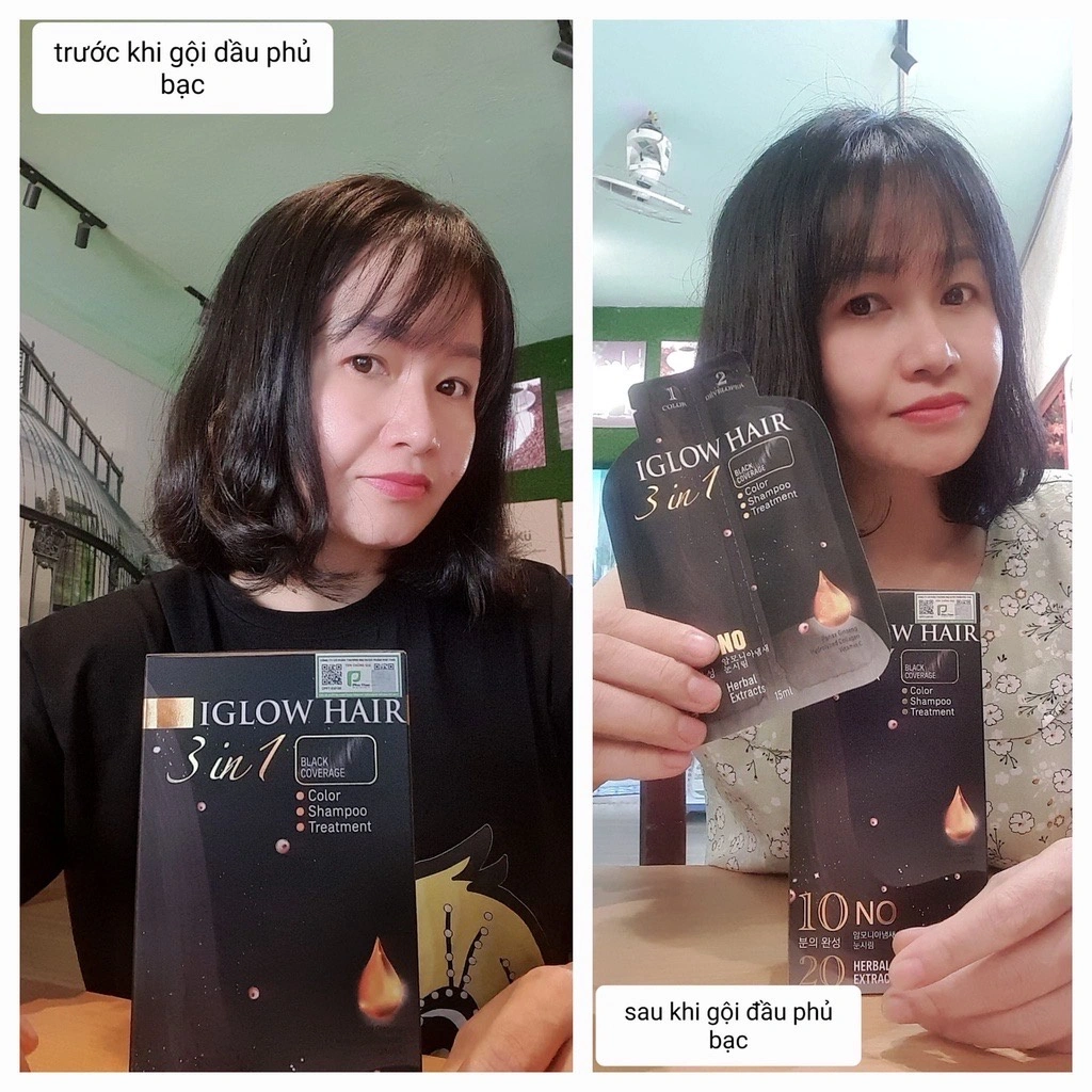 feedback iglow hair - review iglow hair - iglow hair có tốt không - iglow hair có hiệu quả không - Siêu Thị Droppii - 1