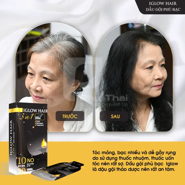 feedback iglow hair - review iglow hair - iglow hair có tốt không - iglow hair có hiệu quả không - Siêu Thị Droppii - 11