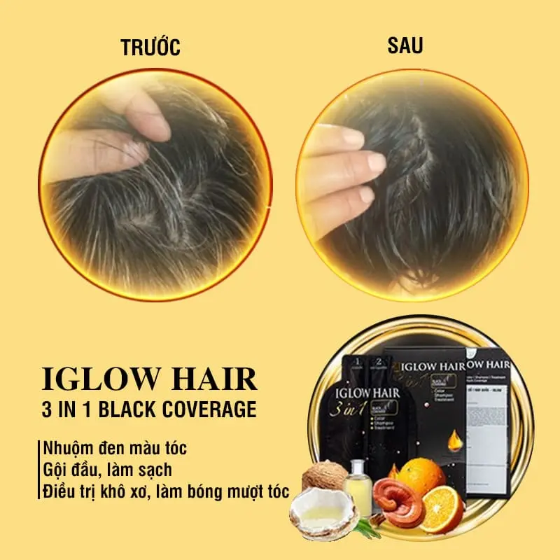 feedback iglow hair - review iglow hair - iglow hair có tốt không - iglow hair có hiệu quả không - Siêu Thị Droppii - 2
