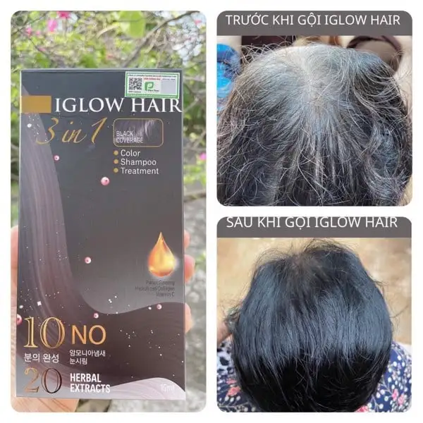 feedback iglow hair - review iglow hair - iglow hair có tốt không - iglow hair có hiệu quả không - Siêu Thị Droppii - 3