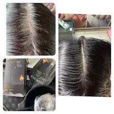 feedback iglow hair - review iglow hair - iglow hair có tốt không - iglow hair có hiệu quả không - Siêu Thị Droppii - 4