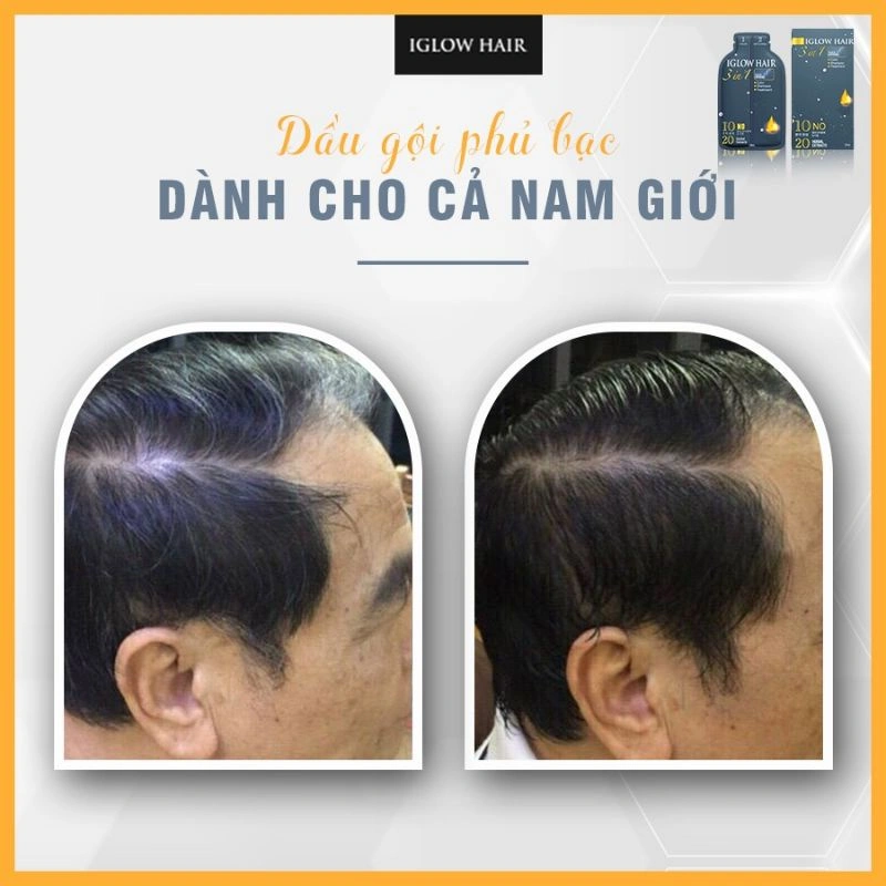 feedback iglow hair - review iglow hair - iglow hair có tốt không - iglow hair có hiệu quả không - Siêu Thị Droppii - 8