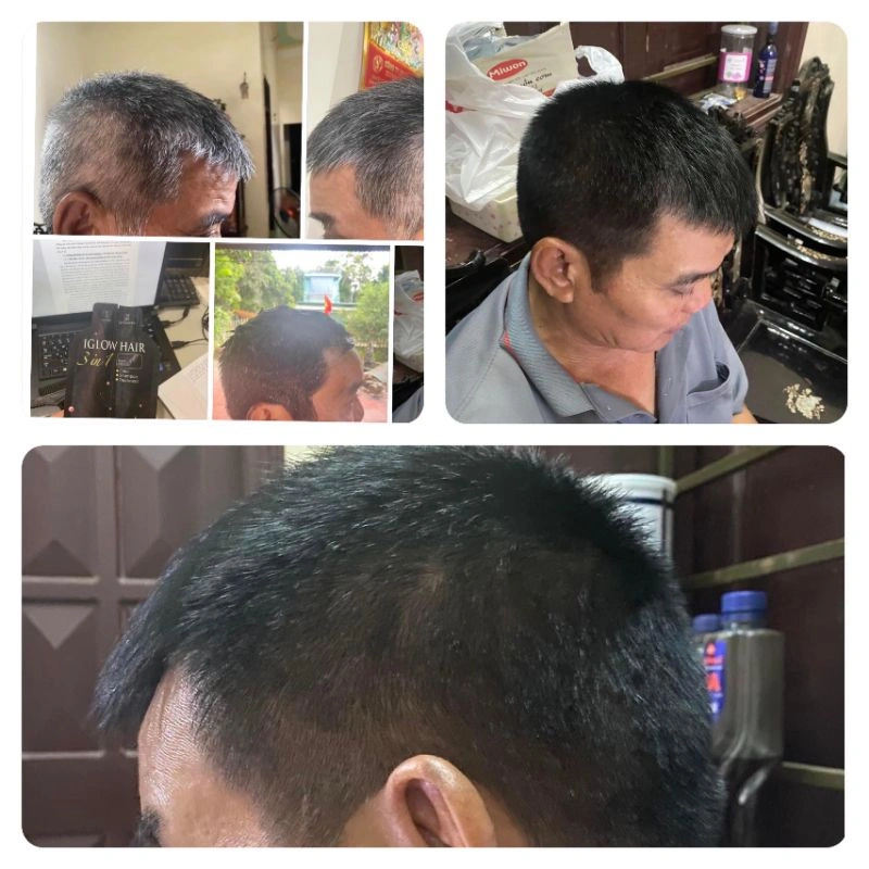 feedback iglow hair - review iglow hair - iglow hair có tốt không - iglow hair có hiệu quả không - Siêu Thị Droppii - 9